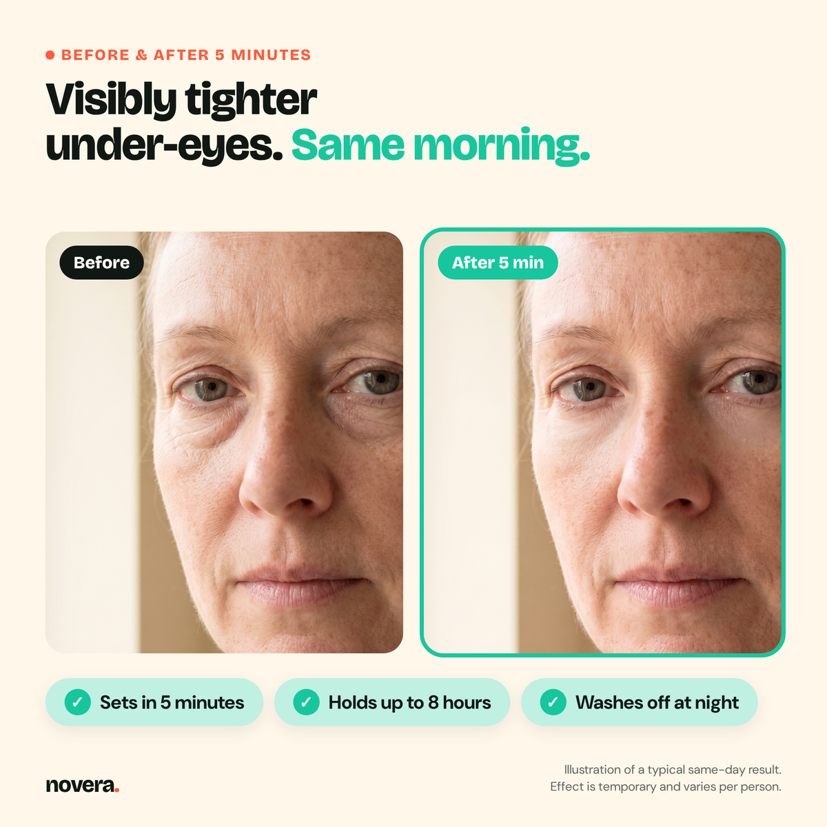 Before and after 5 minutes, under-eye (illustration)