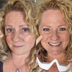 Before and after — EyeLift Pro
